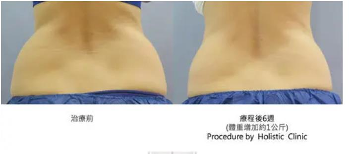 80后女子不满鼻部整形暴力“医闹”获刑四年